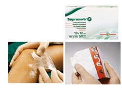 MEDICAZIONE STERILE IN FILM IN POLIURETANO TRASP. SUPRASORB F 10X12CM 10 PEZZI - Antica Farmacia Ferrari